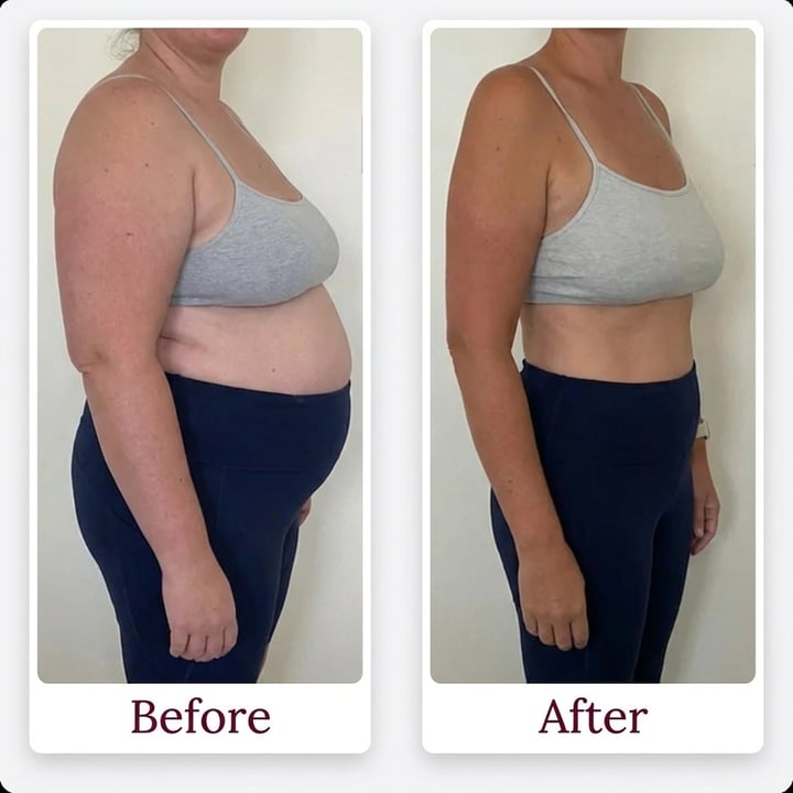 Before and after result photo