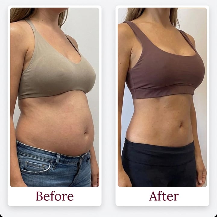 Side-by-side comparison of a person's torso, labeled before and after