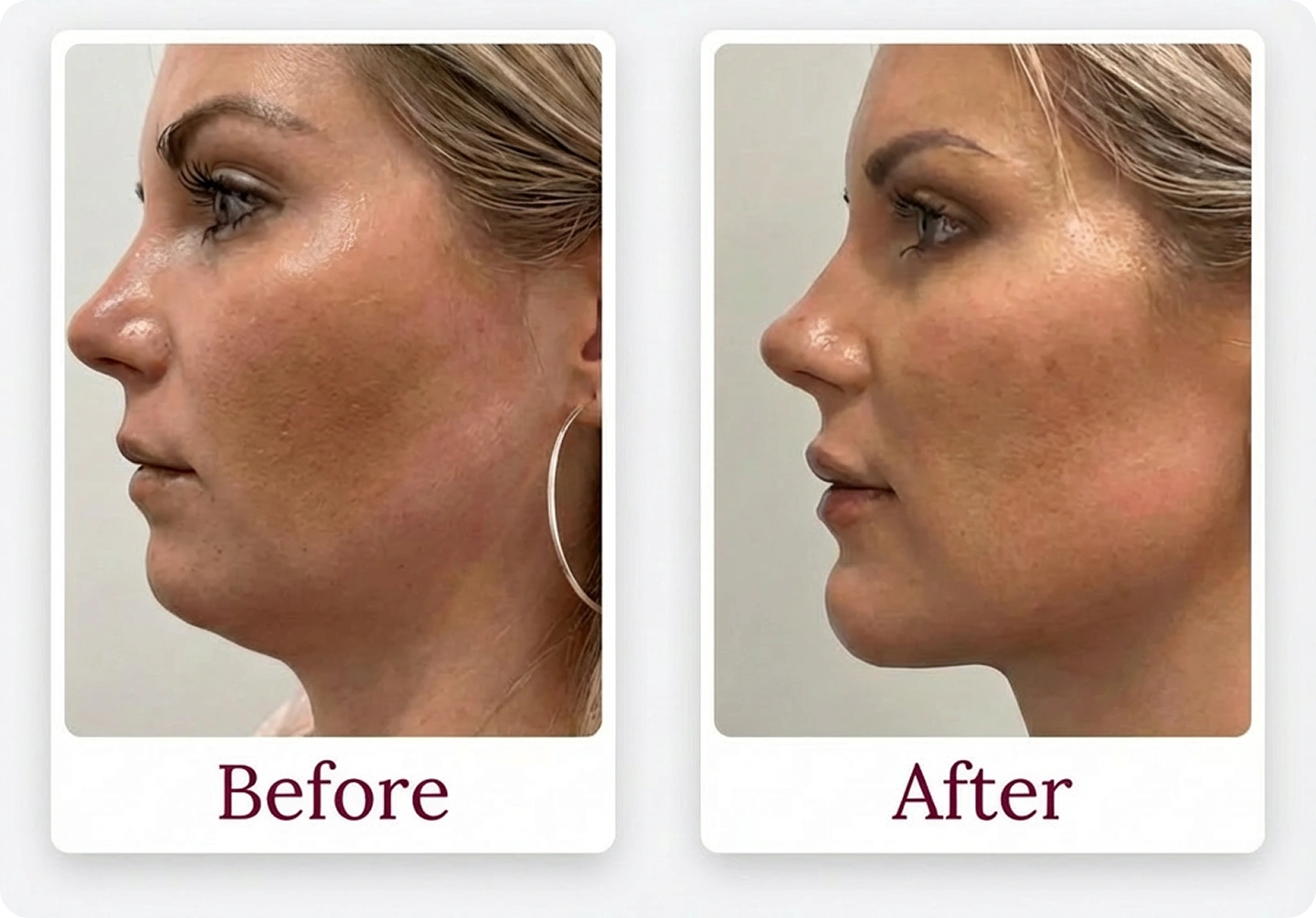 Before and after profile photos