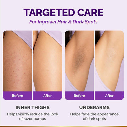 Visual results graphic titled Targeted Care For Ingrown Hair & Dark Spots showing Before and After photos for two areas: Inner Thighs (helps visibly reduce the look of razor bumps) and Underarms (helps fade the appearance of dark spots).