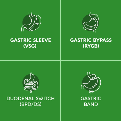 A four-panel graphic illustrating bariatric surgery procedures supported by the product:   Gastric Sleeve (VSG): Designed for post-sleeve gastrectomy nutrition.   Gastric Bypass (RYGB): Suitable for post-Roux-en-Y gastric bypass care.   Duodenal Switch (BPD/DS): Formulated to support biliopancreatic diversion with duodenal switch patients.   Gastric Band: Compatible with lap-band surgical recovery nutrition.   