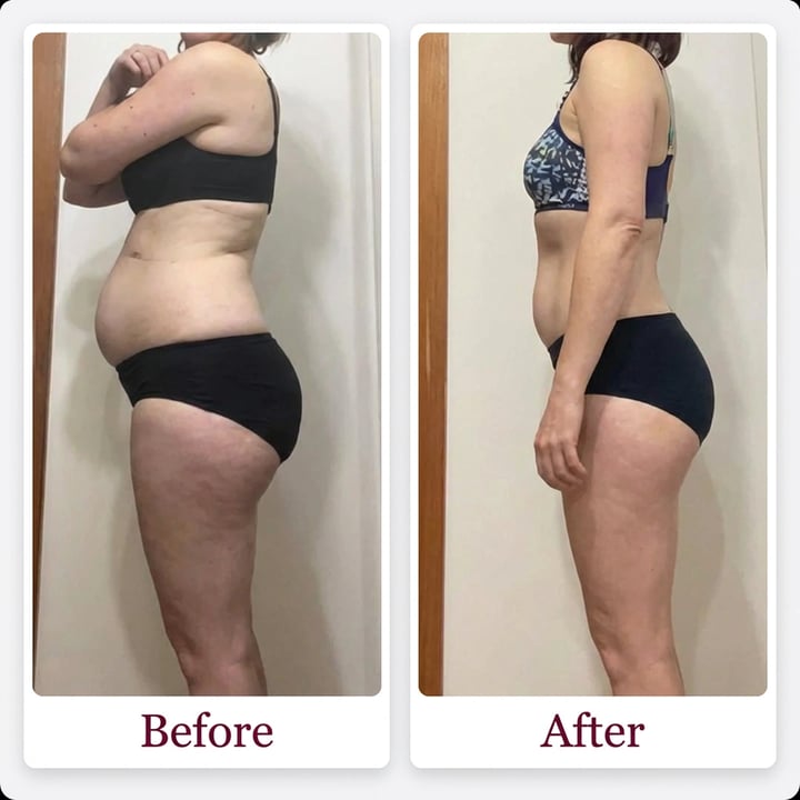 Before and after result photo